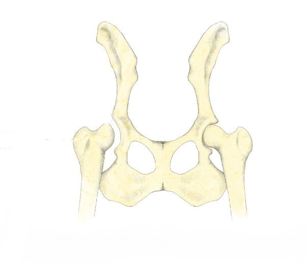 Dysplasie de hanche de chien: diagnostic, traitement et pronostic